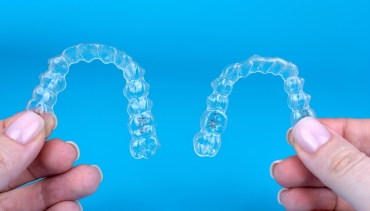 Novitet iz Invisaligna – Invisalign® Moderate